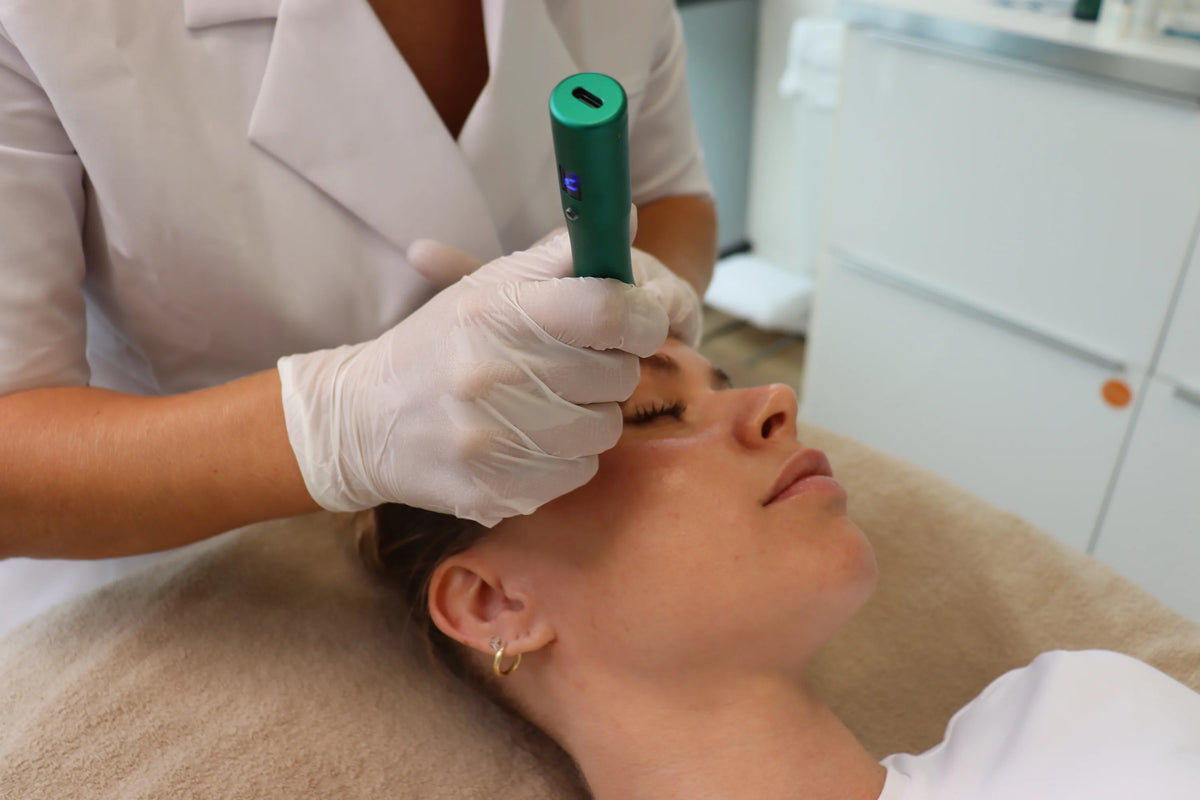 2. Microneedling & actieve verzorging